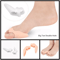 Silicone Gel Toe Separator Corrector Orthotics Straightener Bunion Relief Soft Toe Spacers For Foot 5