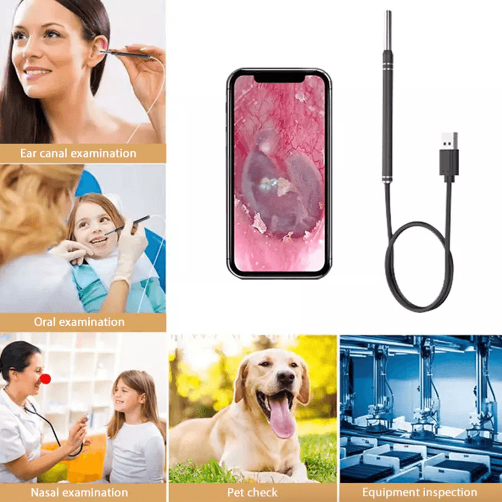 HD LED Ear Endoscope Otoscope Camera Tool Ear Wax Cleaning Camera Cleaner Removal Kit With USB Type 15