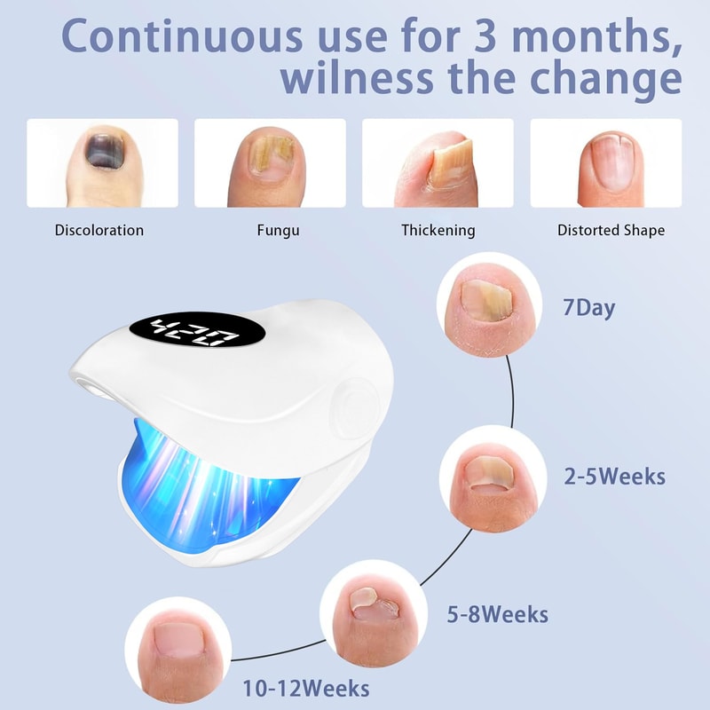 Nail Fungus Laser Treatment Device Wireless Infrared Toenail Repair Therapy