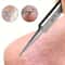 Acne Precision Extractor Tweezers for Blackhead & Blemish Removal
