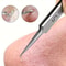 Acne Precision Extractor Tweezers for Blackhead & Blemish Removal