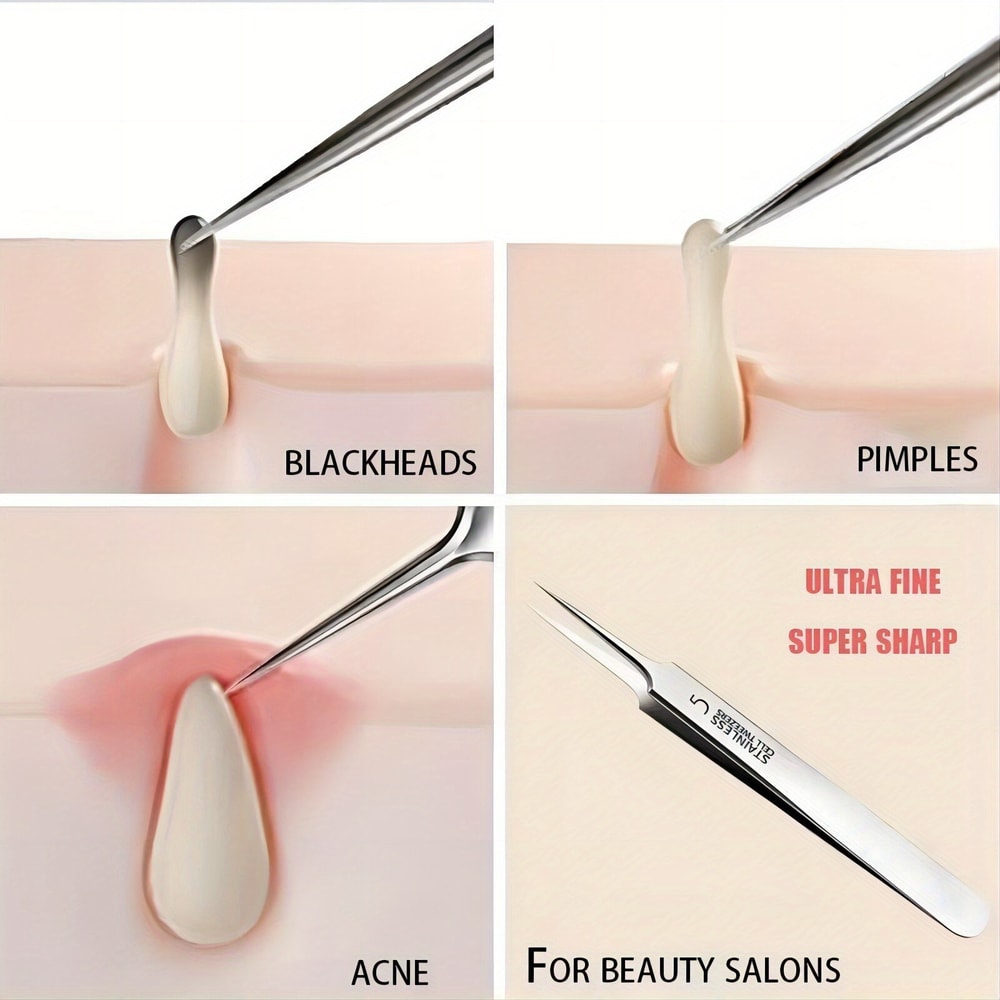 Acne Precision Extractor Tweezers for Blackhead & Blemish Removal