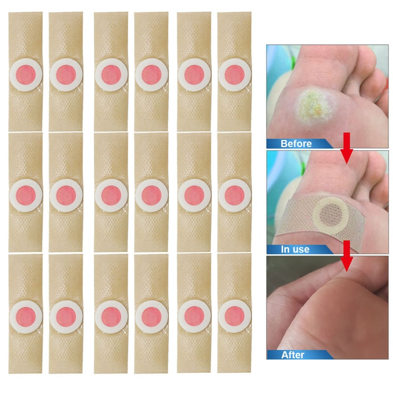 36Pcs Foot Toe Corn And Callus Removers Pads, Self Stick Foot Cushion Corn, Callus Remover Cushions For Foot Care Relief