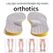 Flat Feet Orthotic Insole Arch Support Orthopedic Insoles For Shoes Sole Support Pad For Men Women 0