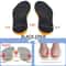 Flat Feet Orthotic Insole Arch Support Orthopedic Insoles For Shoes Sole Support Pad For Men Women 9
