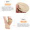 Silicone Insoles For Shoes Forefoot Gel Pads Metatarsal Foot Cushion Womens Breathable Pain Relief  4