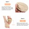 Silicone Insoles For Shoes Forefoot Gel Pads Metatarsal Foot Cushion Womens Breathable Pain Relief 4