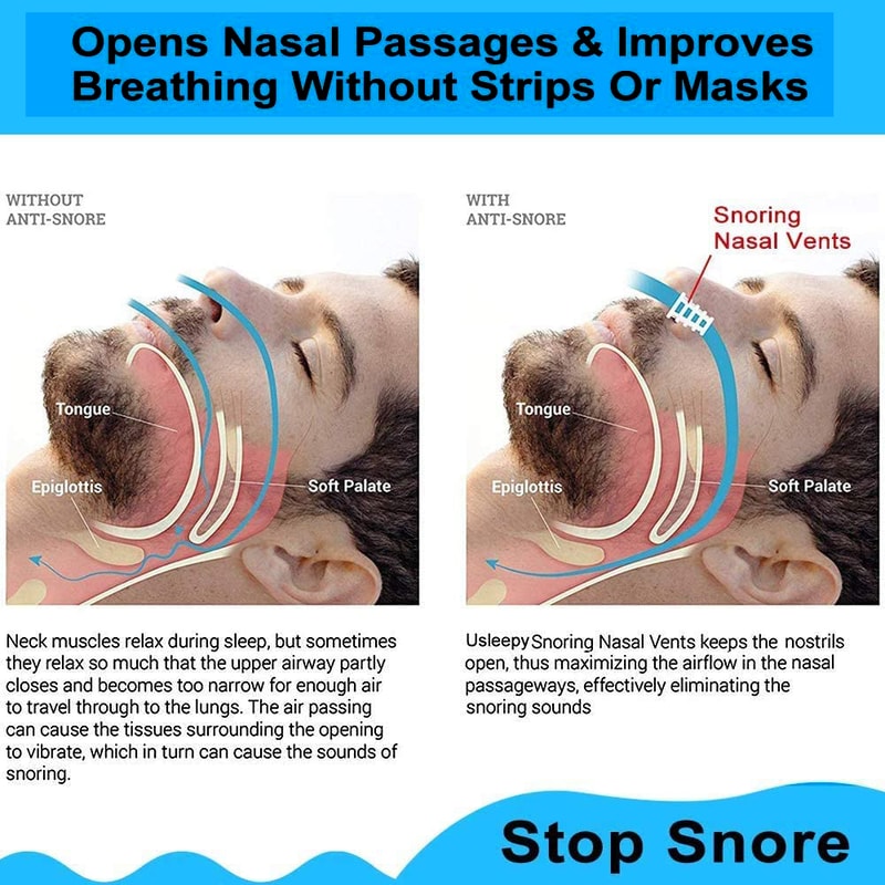 Advanced Anti Snoring Nasal Dilator Stop Snoring Silent Sleep Aid Device 2