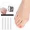 Ingrown Toenail Corrector Kit Nail Brace Filling Pad for Pain Relief