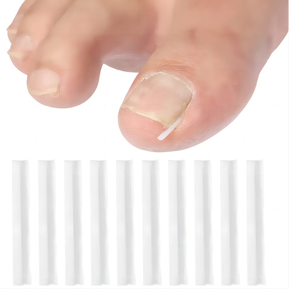 Ingrown Toenail Corrector Kit Nail Brace Filling Pad for Pain Relief