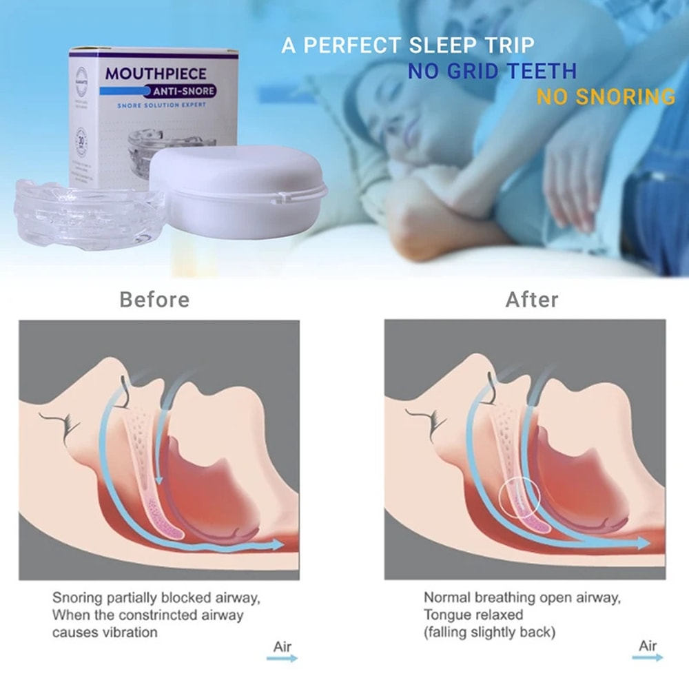 Anti Snoring Mouthpiece Bruxism Sleep Aid Device Improve Sleep Quality 2