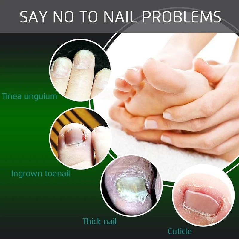 Heavy Duty Toenail Clippers For Ingrown Thick Nails Precision Nail Scissor Stainless Steel Comforta 7