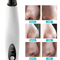 Electric Blackhead Remover Vacuum With Diamond Pore Suction For Glowing Skin 11