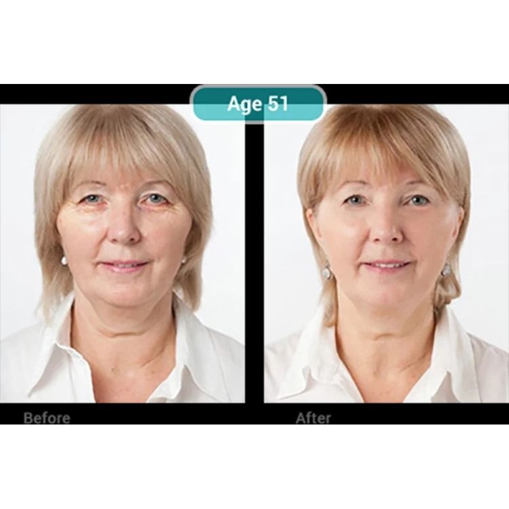 Stem Cell AntiAging Serum With Matrixyl Hyaluronic Acid Collagen Boost Formula 1