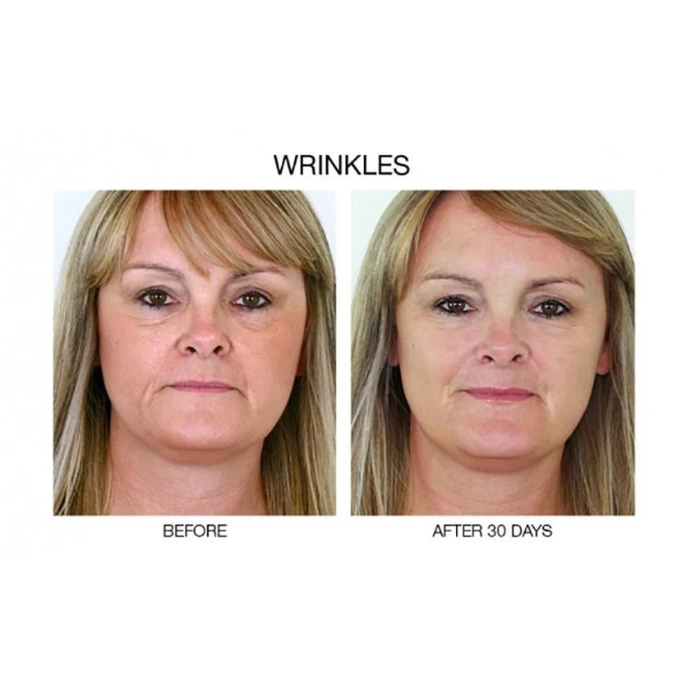 Stem Cell AntiAging Serum With Matrixyl Hyaluronic Acid Collagen Boost Formula 3