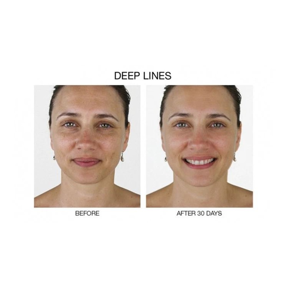 Stem Cell AntiAging Serum With Matrixyl Hyaluronic Acid Collagen Boost Formula 5