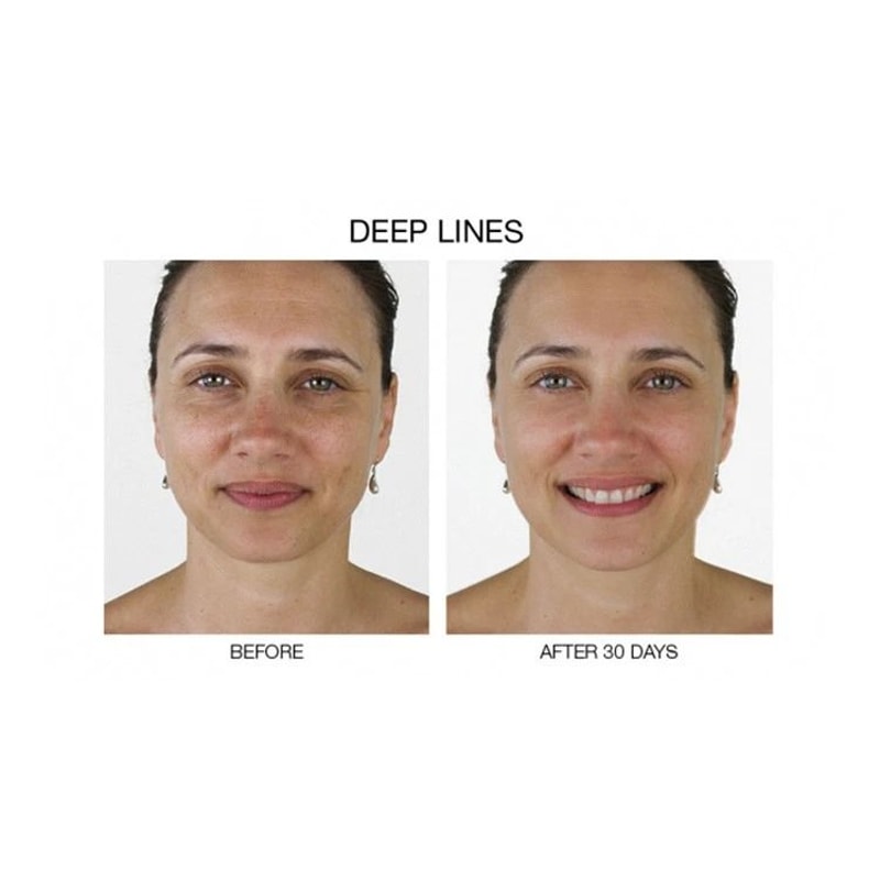 Stem Cell AntiAging Serum With Matrixyl Hyaluronic Acid Collagen Boost Formula 5