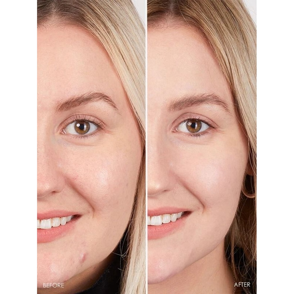 Matrixyl AntiAging Cream With Vitamin C Hyaluronic Acid Retinol Collagen 3