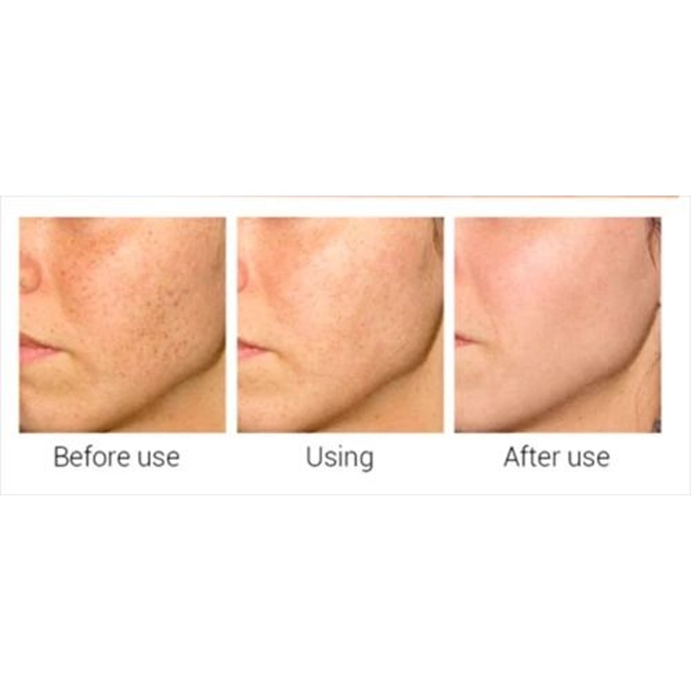 Matrixyl AntiAging Cream With Vitamin C Hyaluronic Acid Retinol Collagen 4