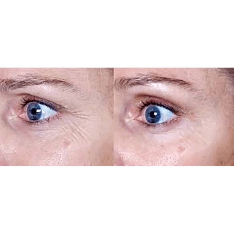 Matrixyl AntiAging Cream With Vitamin C Hyaluronic Acid Retinol Collagen 5