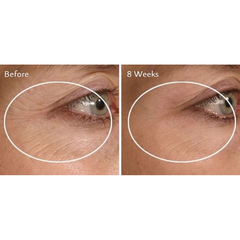 Collagen Booster Serum With Peptides CoQ Hyaluronic Acid AntiAging Formula For Firm Youthful Skin 1