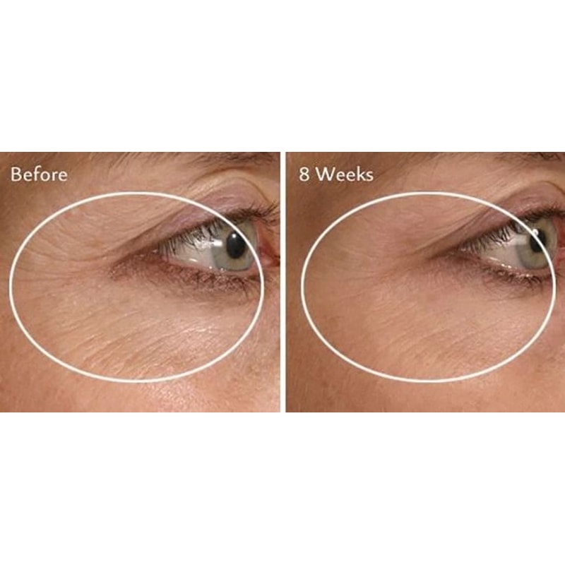 Collagen Booster Serum With Peptides CoQ Hyaluronic Acid AntiAging Formula For Firm Youthful Skin 1