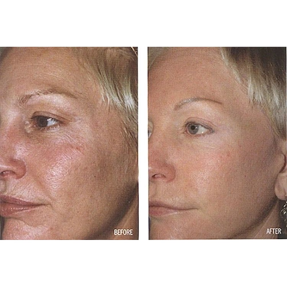 Collagen Booster Serum With Peptides CoQ Hyaluronic Acid AntiAging Formula For Firm Youthful Skin 2