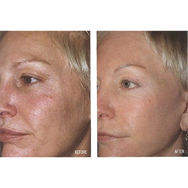 Collagen Booster Serum With Peptides CoQ Hyaluronic Acid AntiAging Formula For Firm Youthful Skin 2