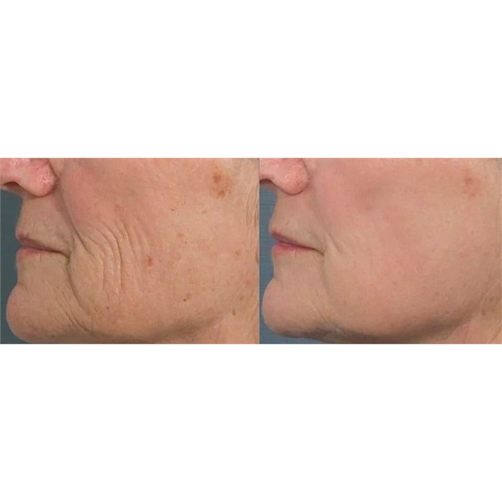 Collagen Booster Serum With Peptides CoQ Hyaluronic Acid AntiAging Formula For Firm Youthful Skin 3