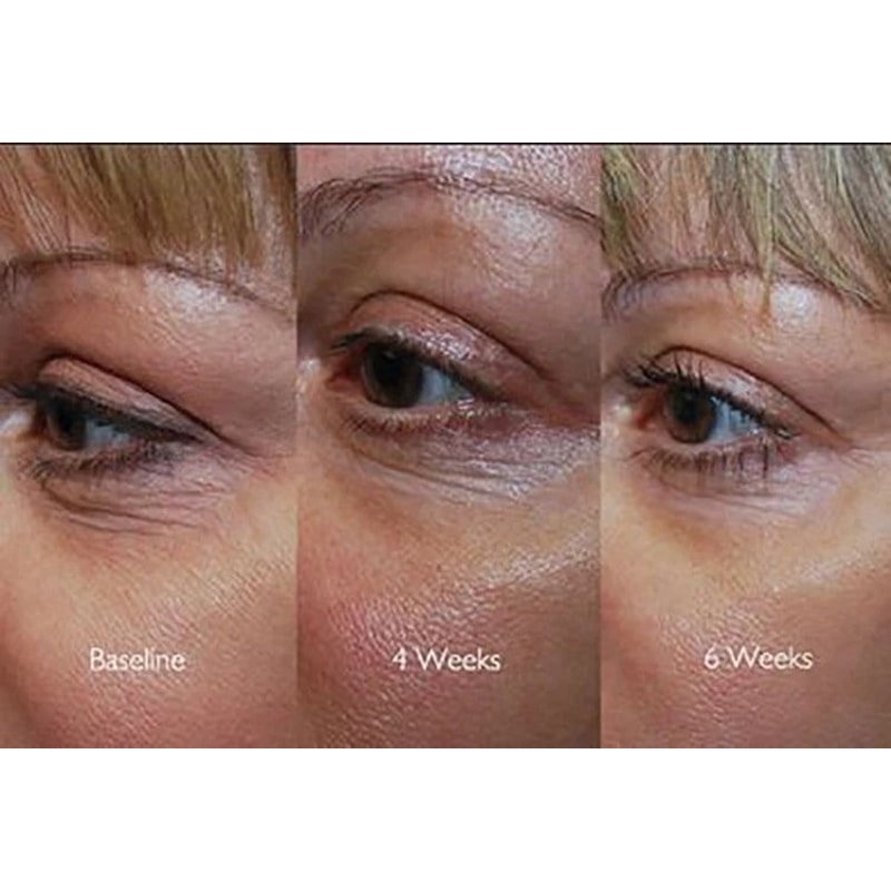 Collagen Booster Serum With Peptides CoQ Hyaluronic Acid AntiAging Formula For Firm Youthful Skin 4