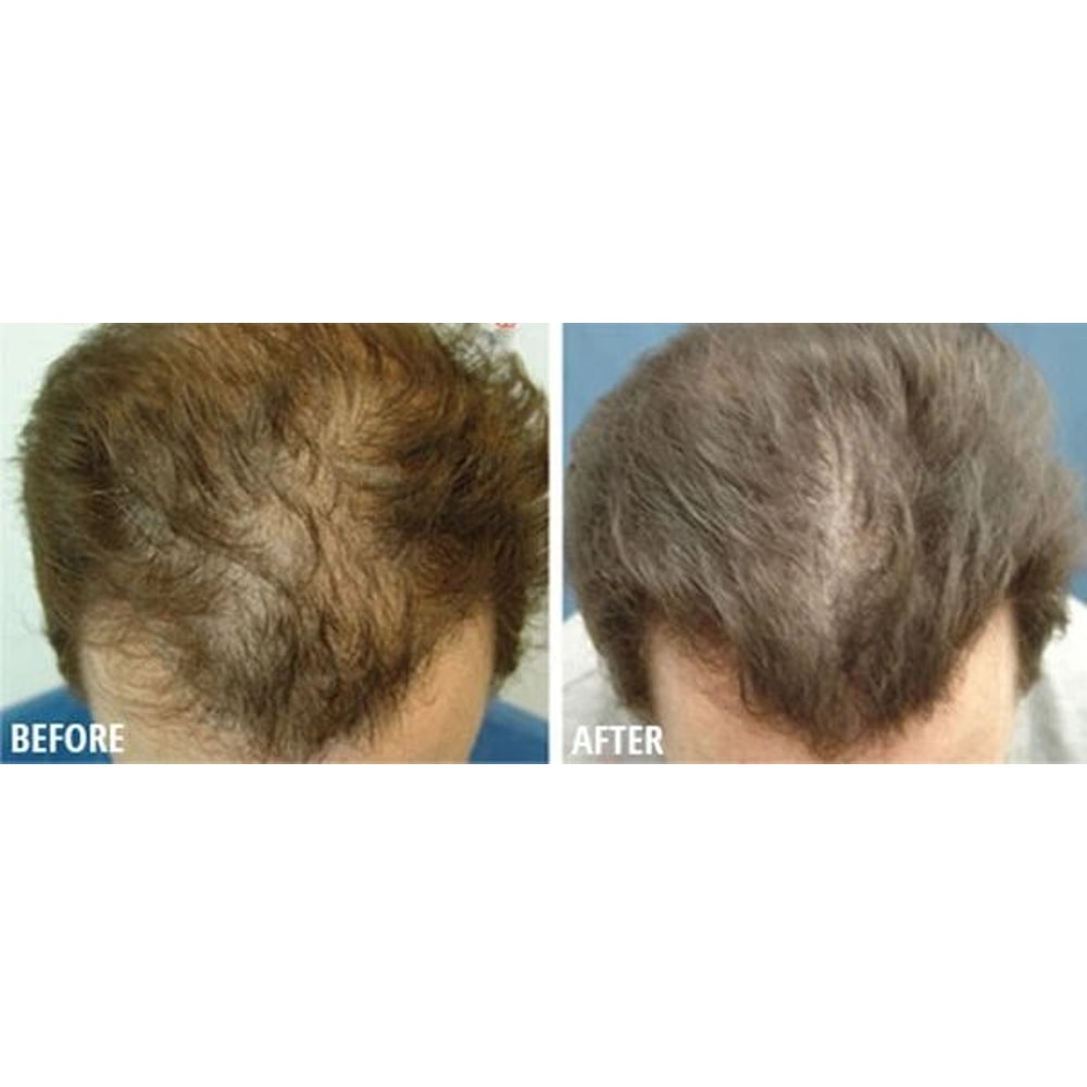 Best Hair Loss Conditioner With 16 Organic Oils For Fast Hair Growth DHT Blocker Therapy For Men W 4