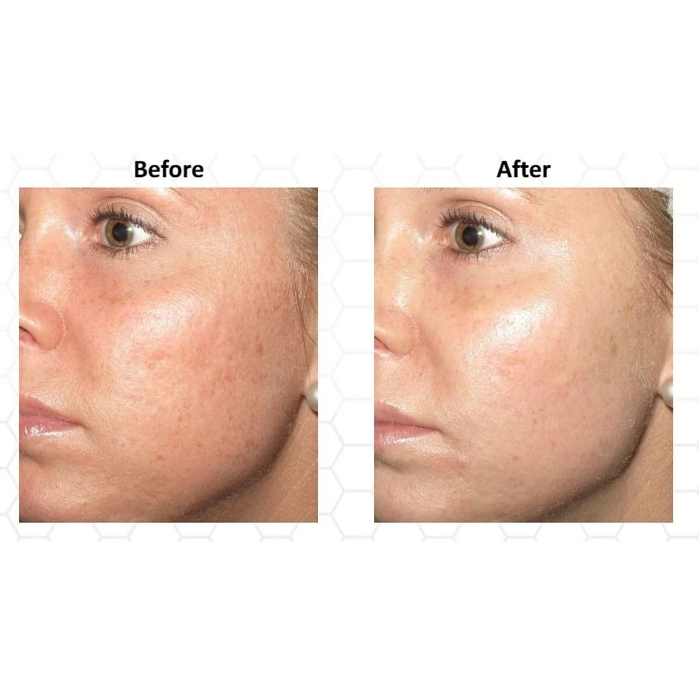 Vitamin C Serum With Hyaluronic Acid Ferulic Acid AntiAging Brightening Hydrating Gel Cream 1