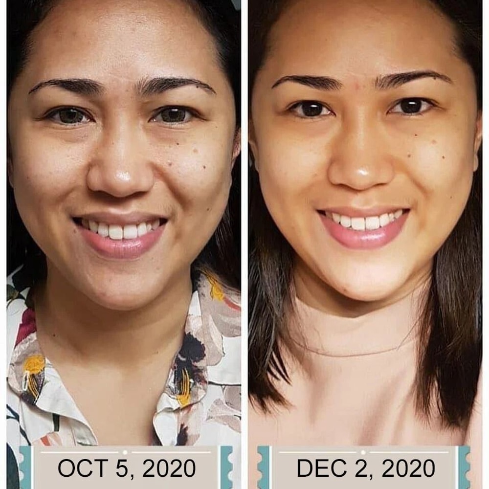 Vitamin C Serum With Hyaluronic Acid Ferulic Acid AntiAging Brightening Hydrating Gel Cream 3