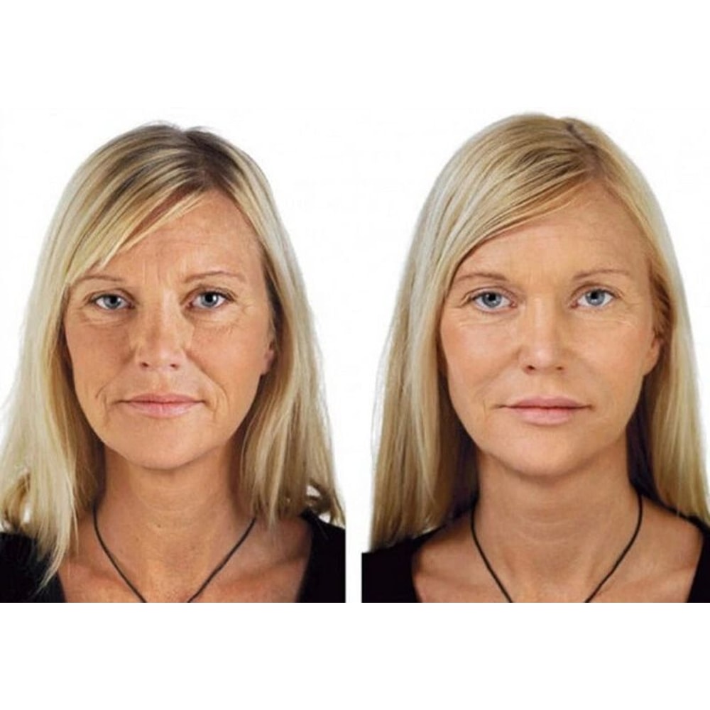 Vitamin C Serum With Hyaluronic Acid Ferulic Acid AntiAging Brightening Hydrating Gel Cream 5