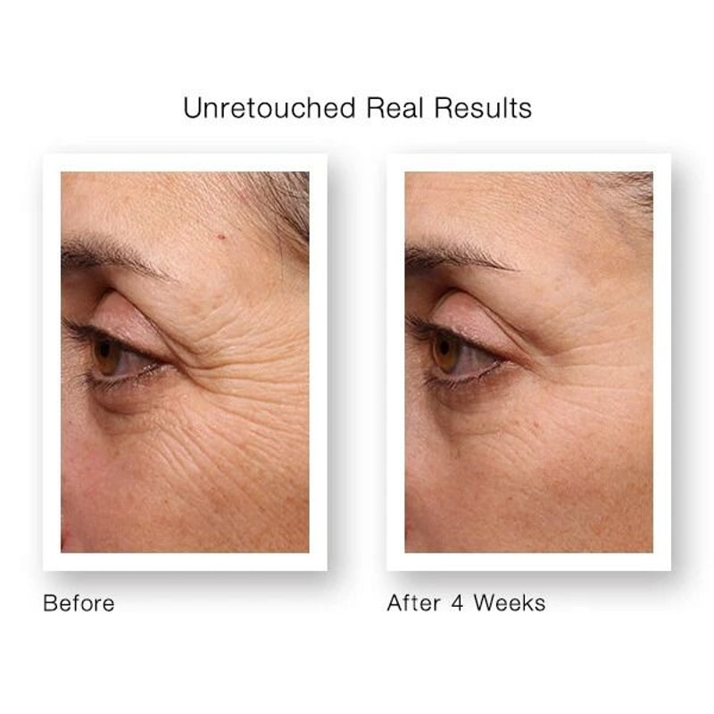 Retinol Wrinkle Cream With Hyaluronic Acid Vitamin E AntiAging Serum 2