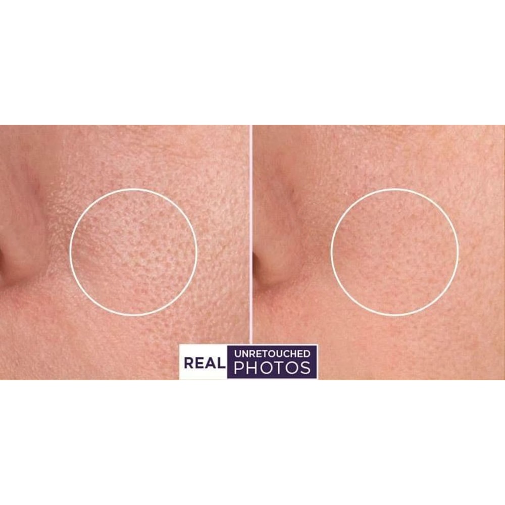 Retinol Wrinkle Cream With Hyaluronic Acid Vitamin E AntiAging Serum 3