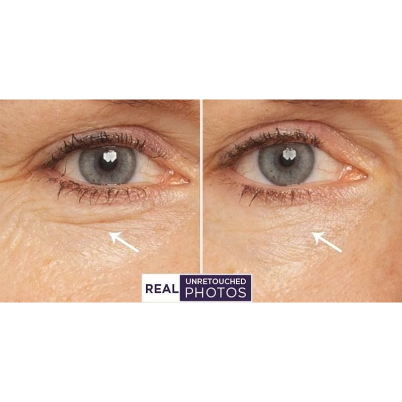 Retinol Wrinkle Cream With Hyaluronic Acid Vitamin E AntiAging Serum 4