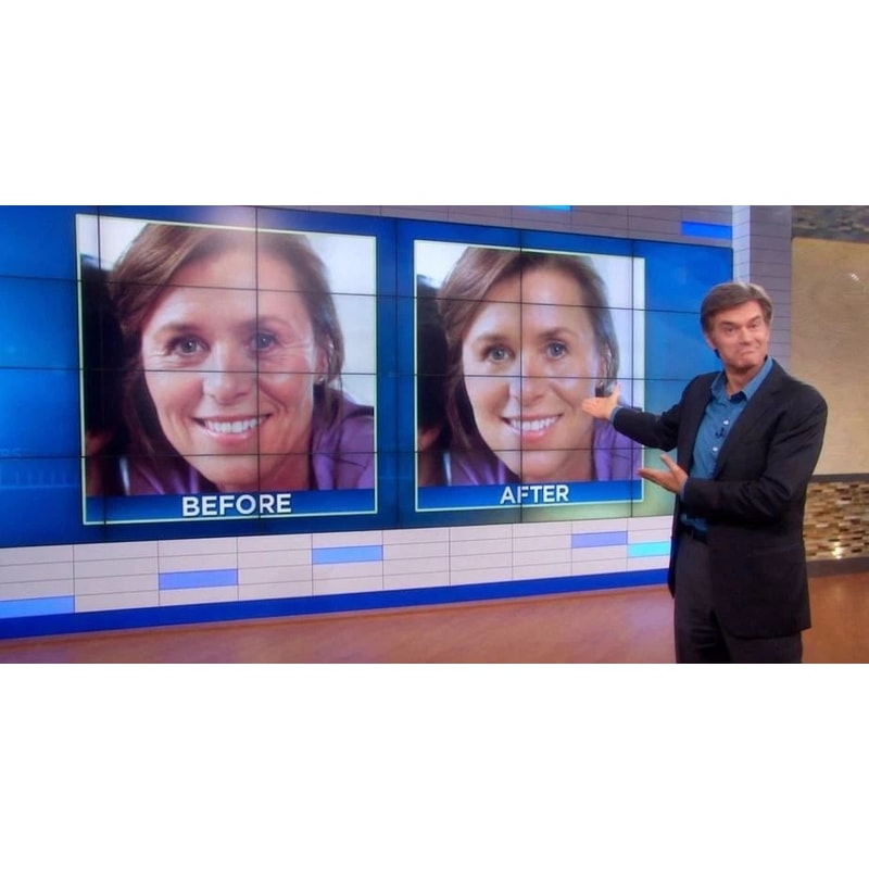 Matrixyl AntiAging Vitamin C Cream With Hyaluronic Acid And Retinol 2