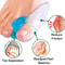 Silicone Gel Bunion Corrector Toe Separator For Big Toe Foot Pain Relief 2