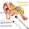 Ear Wax Removal Kit Stainless Steel Ear Cleaner And Ear Pick Set 4