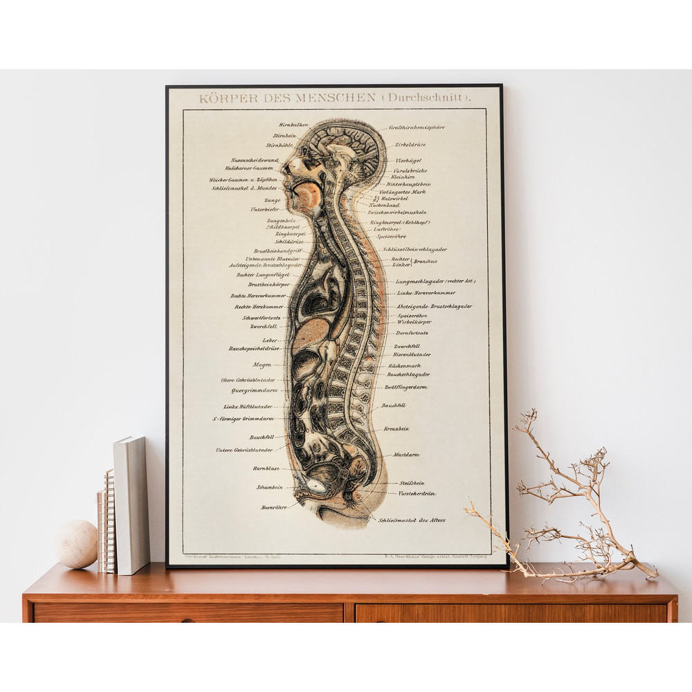 Vintage Human Body Print, Medical Wall Art, Surgical Art, Anatomy Wall Art, Antique Lithograph.jpg