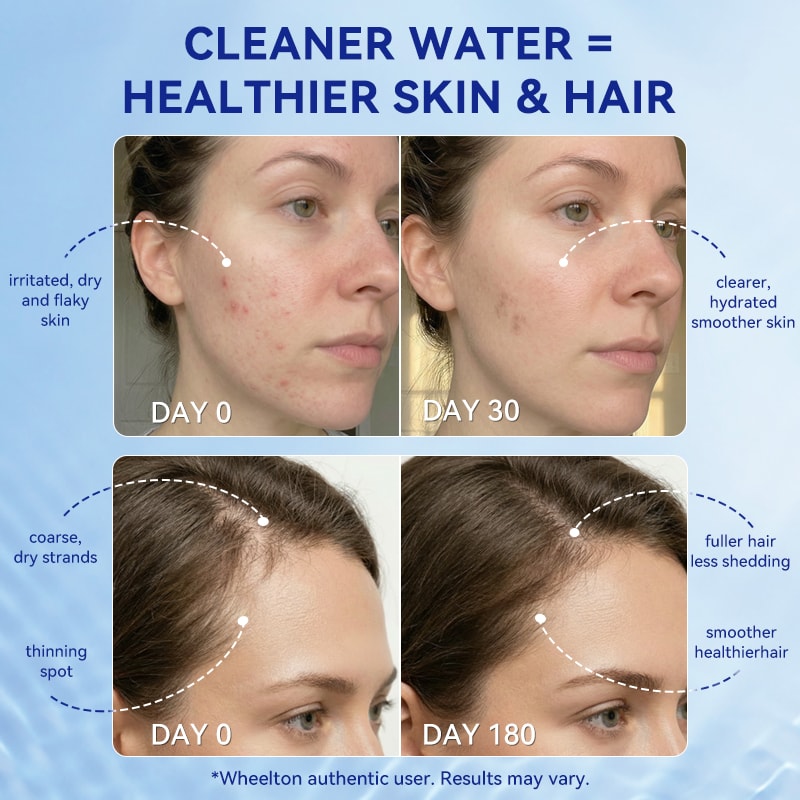 High Pressure Shower Filter For Hard Water Chlorine Removal Skin Hair Care 3