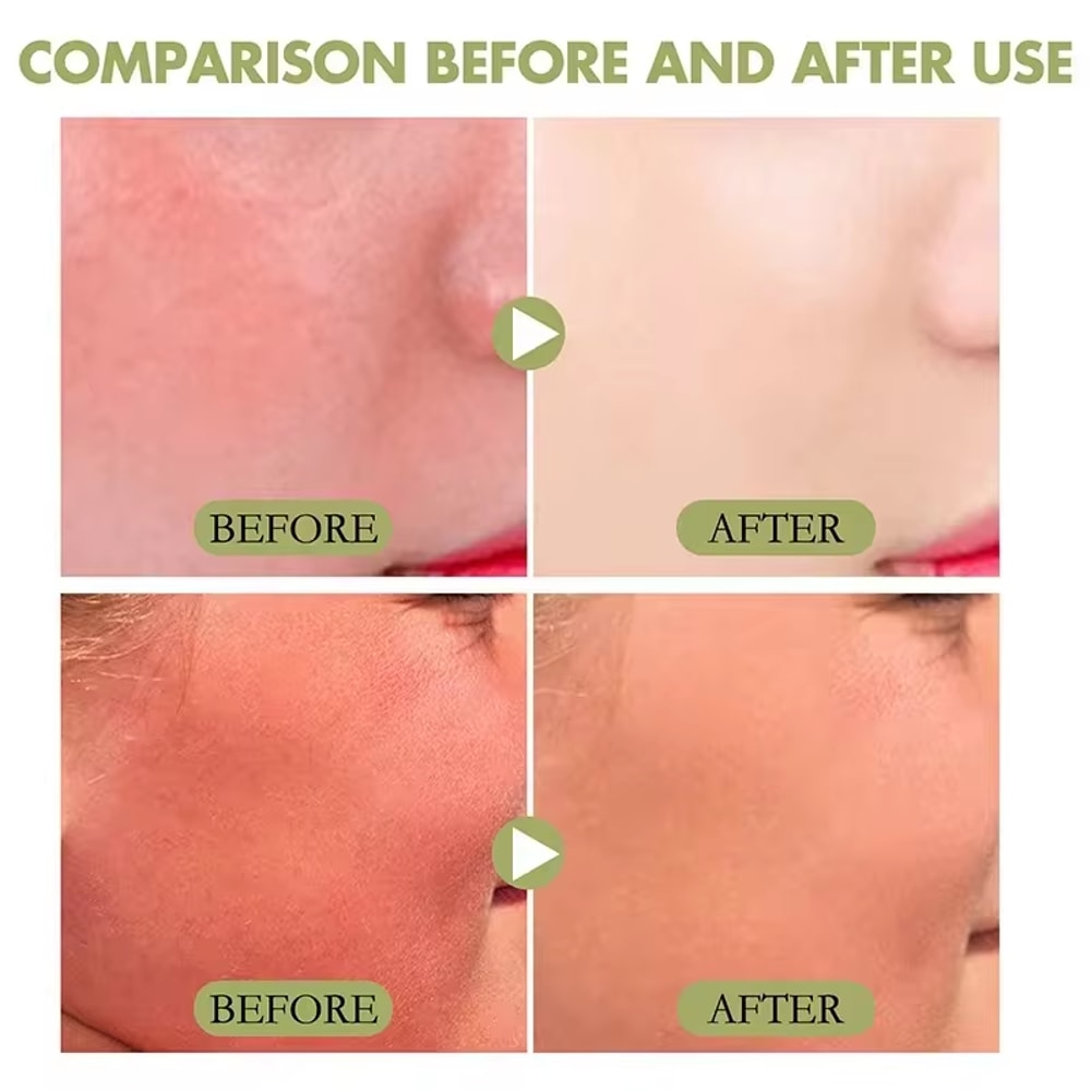 High Protection SPF Facial Body Sunscreen Lightweight Non Greasy UV Shield 1