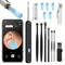 Smart Visual Ear Wax Removal Camera Endoscope with HD Digital Otoscope
