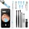 Smart Visual Ear Wax Removal Camera Endoscope with HD Digital Otoscope