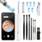 Smart Visual Ear Wax Removal Camera Endoscope with HD Digital Otoscope