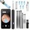 Smart Visual Ear Wax Removal Camera Endoscope with HD Digital Otoscope
