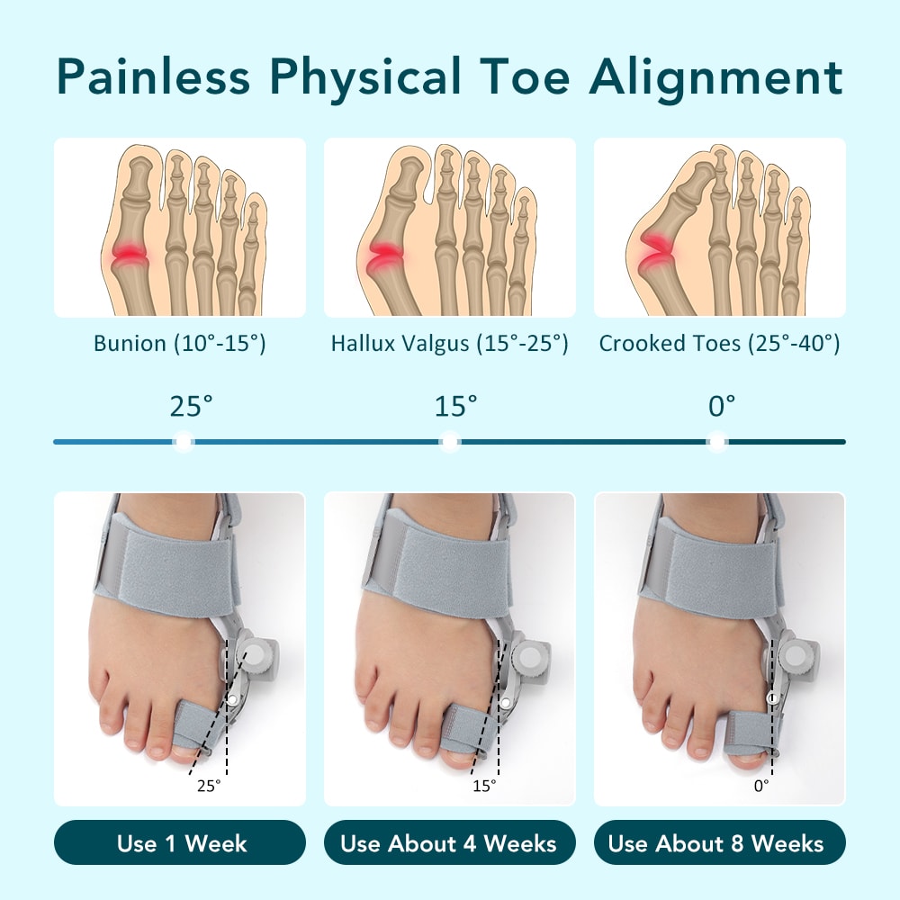 Adjustable Bunion Corrector Toe Straightener For Pain Relief And Hallux Valgus Support 1