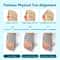 Adjustable Bunion Corrector Toe Straightener For Pain Relief And Hallux Valgus Support 1