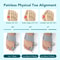 Adjustable Bunion Corrector Toe Straightener For Pain Relief And Hallux Valgus Support 1